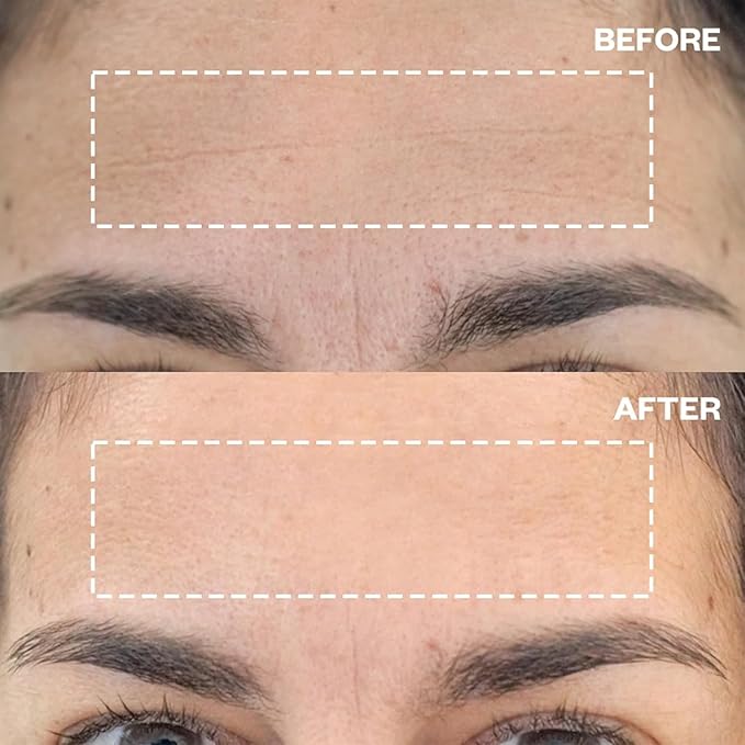 Wrinkles Schminkles Forehead Wrinkle Patches, 4-Pack, Reusable Hypoallergenic Silicone Smoothing Pads for Reducing Frown Lines & Face Lift Overnight-Velvo Beauty