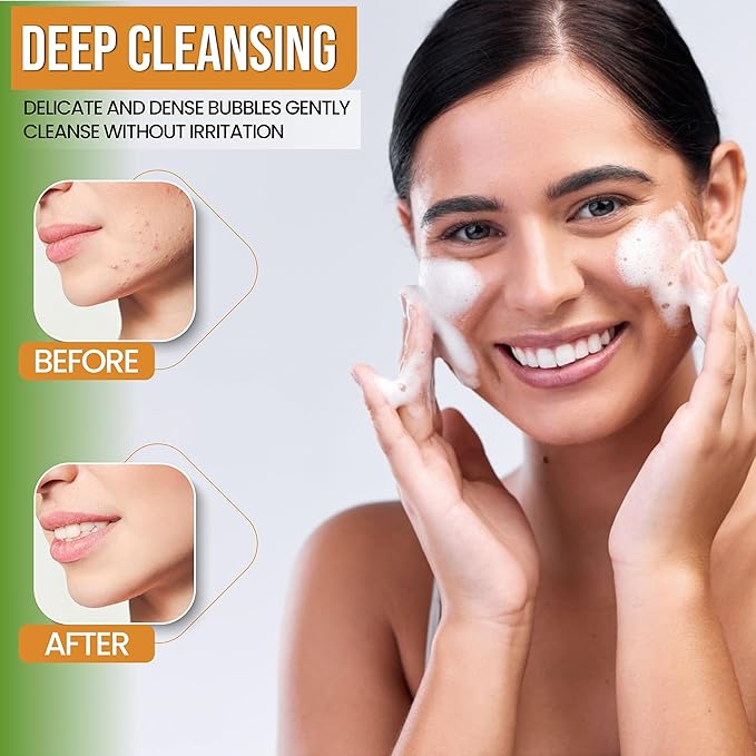 Turmeric Face Wash - Turmeric Facial-Cleanser with Aloe Vera, Vitamin E, and Natural Extracts - Lightweight Daily Gel Face Wash for All Skin Types - 120ml-Velvo Beauty
