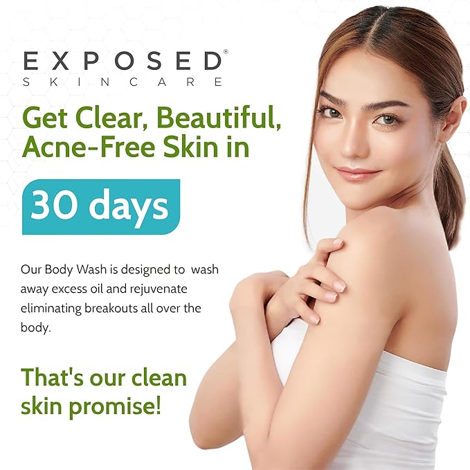 Exposed Skin Care Body Wash - Back and Body Acne Wash with Salicylic Acid and Tea Tree Oil – Exfoliating Bacne Treatment for Clearer, Healthier Skin – Body Cleanser for All Skin Types (12 fl oz)-Velvo Beauty