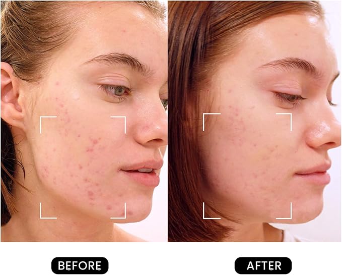 Revive Skincare for Anti-Aging, Glow Like Never Before,Multifunctional Beauty Device, Facial Massager for Home use-Velvo Beauty