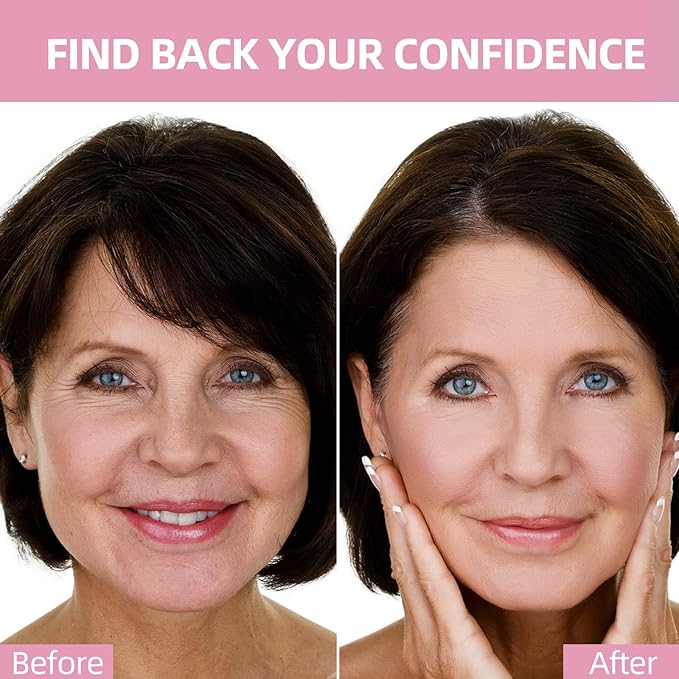Face Wrinkle Patches – for Forehead Lines, Frown Areas, Smile Creases & Fine Signs – Overnight Anti-Aging Facial Stickers to Smooth Skin, Safe and Gentle for All Skin Types, 160 Pcs Included-Velvo Beauty
