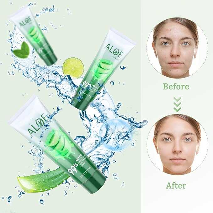 200x2 ML Aloe Vera Gel – 99% Organic Pure Aloe Vera Hydrating Face & Body Moisturizer, Natural Aloe Cream for Dry Skin, Sunburn, Acne, Soothing & Moisturizing-Velvo Beauty