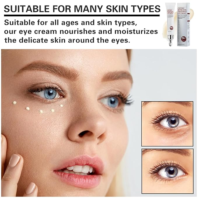 Eye Cream for Dark Circles Bags Eye Cream Eye Products Under Eye Bags Dark Circles-Velvo Beauty