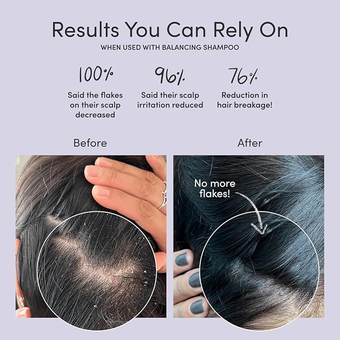 Jupiter, Dermatologist-Formulated Anti-Dandruff Shampoo, Conditioner, & Scalp Scrubber, for Women & Men, for Flaky, Itchy, Oily, & Dry Scalp, Vegan, Sulfate-Free, Color-Safe, & Paraben-Free, with Zinc-Velvo Beauty