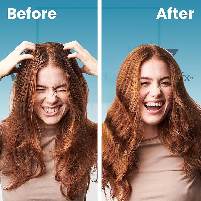 SUDZZFX Refresh Ultimate Dry Shampoo for Women - Waterless Shampoo - for Most Hair Types - Absorbs Excess Oil - Adds Light Volume & Texture - Color Protection-Velvo Beauty
