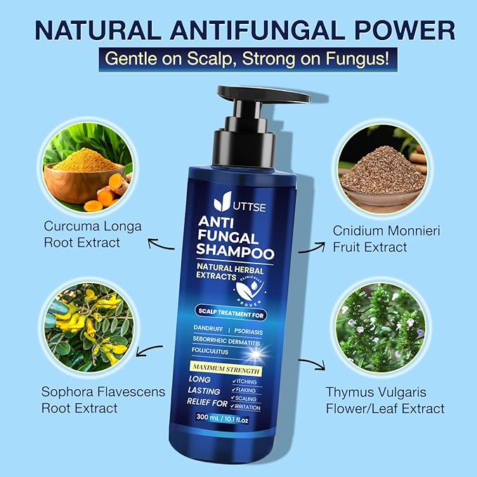 Anti-Fungal Shampoo for Scalp Psoriasis: Dandruff Shampoo for Folliculitis and Seborrheic Dermatitis - Relieves Itchy & Dry Scalp - 300 mL / 10.1 fl.oz-Velvo Beauty