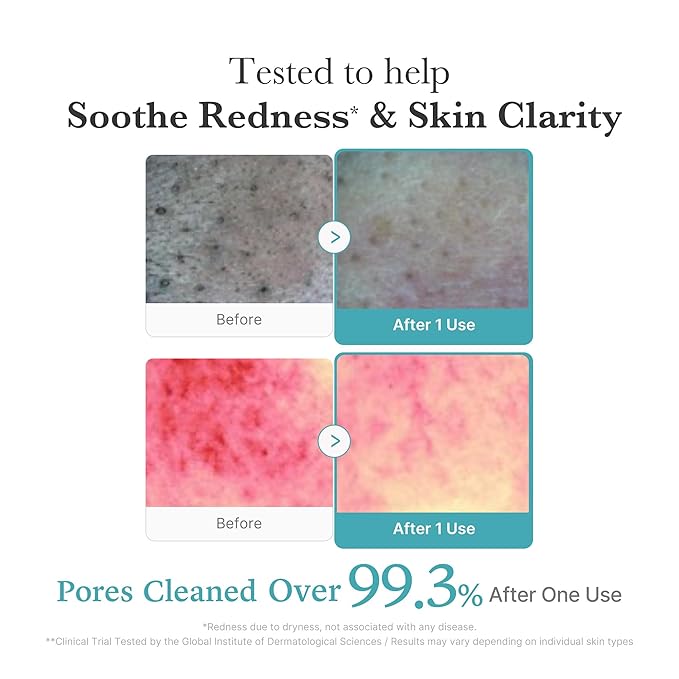 medicube Azelaic Acid Gummy Whip Cleanser | Cleansing Foam For Troubled Skin | Use After Spot Care & Excess Sebum Control | Niacinamide, Glycerin | Soothing, Pore Cleansing Face Wash | Korean Skincare-Velvo Beauty