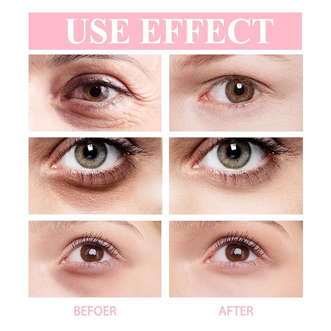 Retinol Eye Stick with Vitamin C Eye Cream for Dark Circle and Puffiness, Brightening Eye Balm Reduces Fine Lines and Bags in 4 Weeks-Velvo Beauty