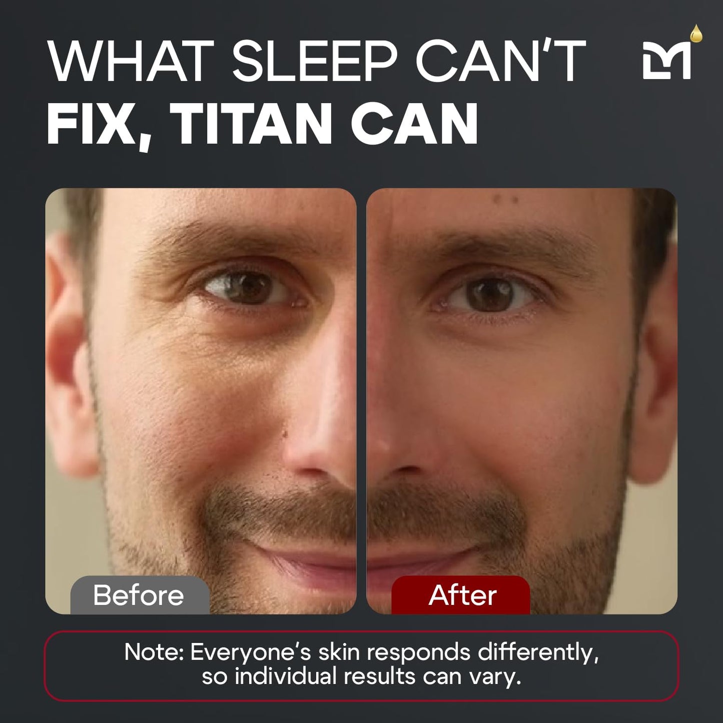 Titan Peptide Cooling Eye Gel – Mens Eye Cream – Anti-Aging Bags & Dark Circle – Eye Bags Treatment for Men – High Potency – Puffy Eyes Treatment for Men – Peptides, HA, DMAE, MSM – Unscented-Velvo Beauty