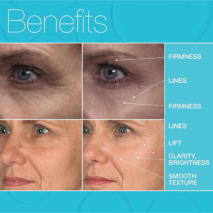 MD Complete Eye Wrinkle Duo | Professional Dermatologist Skin Rejuvenation | includes Wrinkle & Radiance Remedy PLUS with Retinol and Total Eye Treatment with Hyaluronic Acid and Peptides | Set of Two-Velvo Beauty