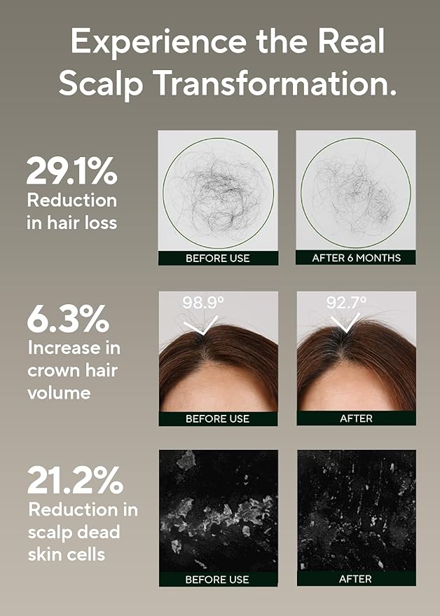 AROMATICA Rosemary Salt Scrub Shampoo - Hair Loss Korean Scalp Detox Shampoo with Rosemary Scalp Oil | Scalp Exfoliator with Salt Scrub for Oily Scalp | Sulfate Free, Silicone Free (10.5 oz / 300g)-Velvo Beauty