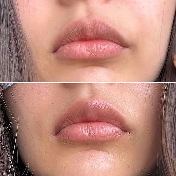 Talika Smile Patch | New Hydrating Lip Mask | Helps To Moisturize, Replenish And Nourish The Lips-Velvo Beauty