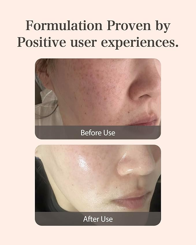 MASTINA Mastic Ampoule Serum Dropper Type (0.5fl oz, Pack of 2) White Mastic Complex 63%, Tranexamic Acid 2%, Niacinamide 5% - Face Serum for Firming, Hydrating, Radiant Glass Skin. Korean Skin Care-Velvo Beauty