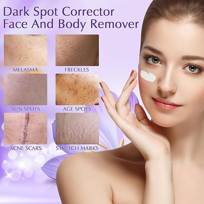 Dark Spot Remover for Face Cream, Dark Spot Corrector, Rapid Tone Repair Retinol Serum for Sun Spots, Age Spots, Skin Brown, Melasma Skin Care with Upgraded Formula Vitamin C for Women 1.7 Fl OZ-Velvo Beauty