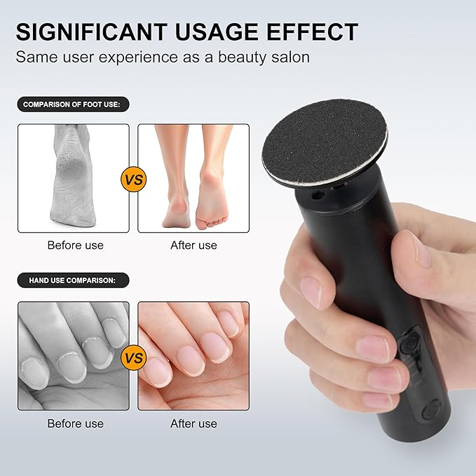 Electric Foot Callus Remover, Adjustable Speed Rechargeable Foot Sander Pedicure Tools for Feet Dead Skin with Sandpaper Disk and Nail Drill Bits,Equipped with Digital Display(Obsidian)-Velvo Beauty
