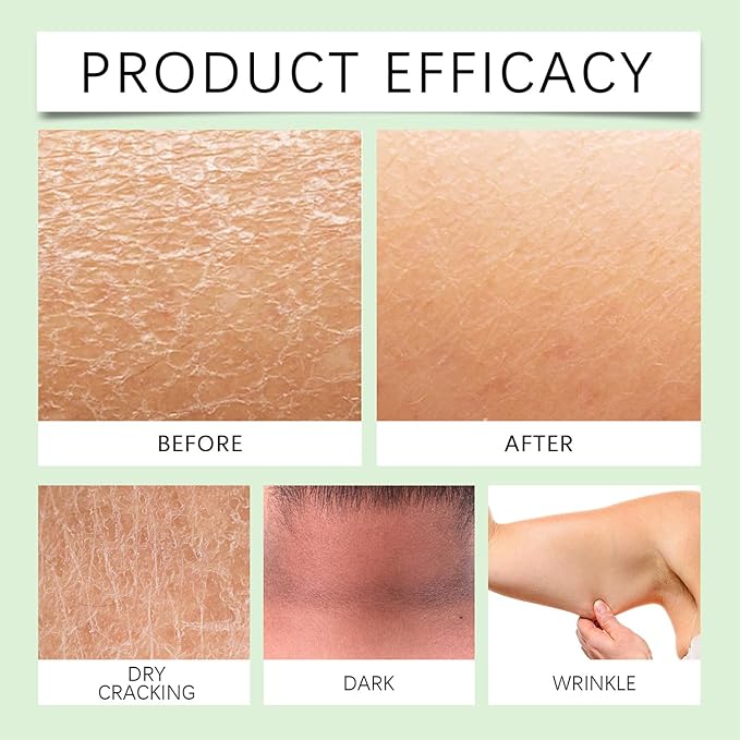 Body Lotion from Korea Whitening Remove Dark Spots, Original Niacinamide Whitening Body Lotion for Dry, Rough & Sensitive Skin, Moisturizing & Nourishing (1)-Velvo Beauty