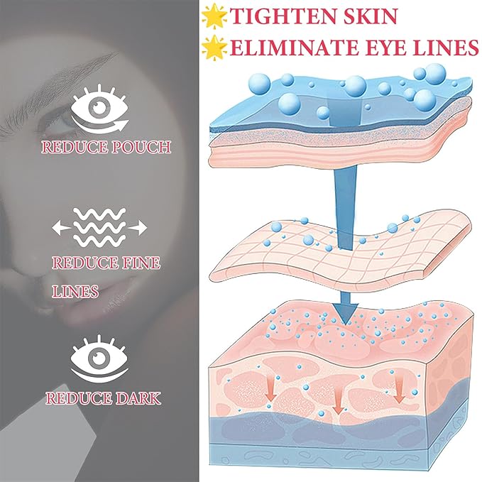 Retinol Eye Cream for Dark Circles and Puffiness,Under Eye Cream with Collagen & Hyaluronic Acid,Fix Wrinkle,Lightweight Lift Eye Cream,Brighten Tighten Eye Cream Gel to Smooth Fine Lines & Hydrate-Velvo Beauty