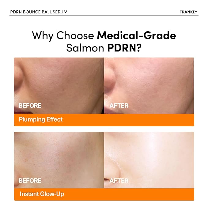 FRANKLY Salmon PDRN Bounce Ball Serum – PDRN Salmon DNA Serum for Plumping, Firming & Glass Skin | Glowing skin Booster | Lightweight, Non-Sticky Korean Skincare | 1.01 fl oz-Velvo Beauty