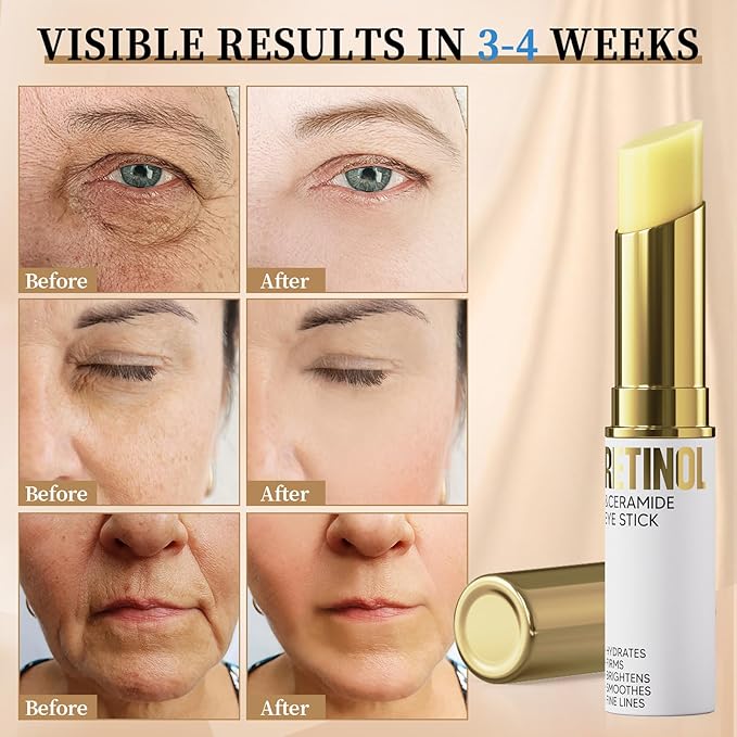 Retinol Eye Stick, Eye Cream for Dark Circles and Puffiness, Hydration and Brightening Eye Balm, Under Eye Cream Anti Aging Visible Results in 3-4 Weeks Reduces Fine Lines Bags-Velvo Beauty