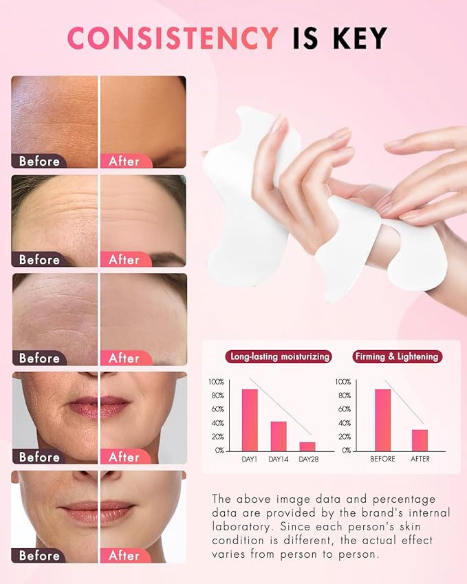 Forehead Wrinkle Patches & Smile Line Patches, Overnight Facial Wrinkle Treatment with Hyaluronic Acid, Aloe, Collagen & Vitamin E to Lift Smile Lines for Women 36pcs-Velvo Beauty