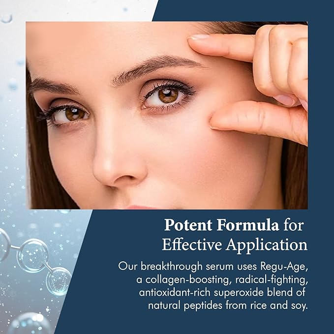Extreme Dark Circle Serum - Under Eye Treatment for Dark Circles, Puffiness, Wrinkles & Fine Lines - Revitalizing, Anti-Aging & Eye Depuffer Serum for Eye Skin Care l 30 ml-Velvo Beauty