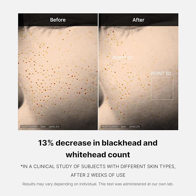 Medicube Zero Pore One-day Serum 1.01 fl.oz - Overnight Resurfacing Serum with Pore Tightening Complex - 15.2% AHA+BHA+PHA & 2% Niacinamide - 10.8% reduction in pore appearance after one day of use-Velvo Beauty