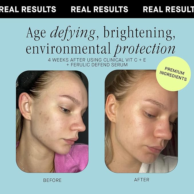 Brandefy Vitamin C Face Serum 15% L. Ascorbic Acid, Ferulic Acid .5% + Vitamin E for Self Care and Beauty, Face Dark Spot Corrector and Anti Aging 1oz, Made In The USA-Velvo Beauty