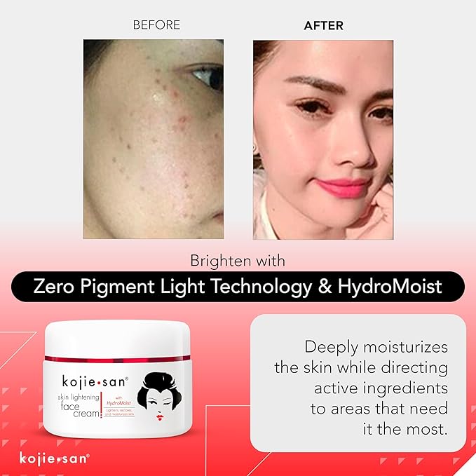 Kojie San Face & Body Complete Brightening Mini Set - 65 Gram x 2 Bars Soap, Body Lotion, Face Cream, and Facial Cleansing Brush-Velvo Beauty