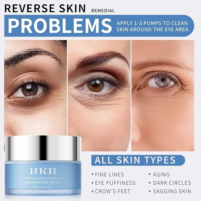 Dark Circles Under Eye Treatment for Women - Eye Cream for Dark Circles Wrinkles Puffiness & Fades Eye Wrinkles – Brighten the Eye Area Anti-Aging Collagen Eye Cream – Retinol Peptide-Velvo Beauty