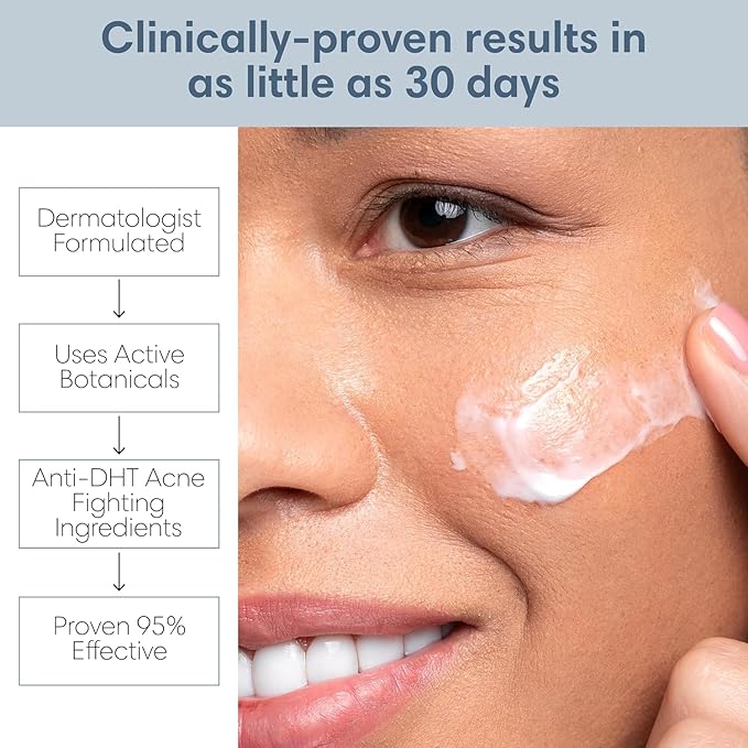 Clarifying Toner for Acne and Blemishes, Face Toner, Facial Toner, Skin Toner, Acne Toner, Toner Oily Skin, Salicylic Acid Toner, Astringent for Face, Toners, 4 Fl Oz-Velvo Beauty