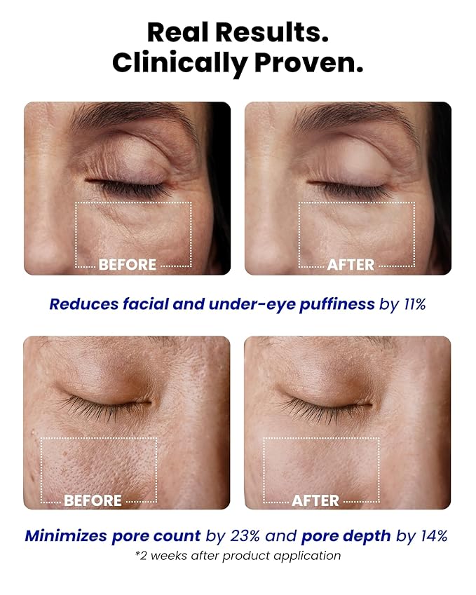 Ice Roll Serum | Cooling & Hydrating Roll-On Serum for Face, Puffy Eyes, Tannin & Panthenol for Pore Minimizing, Soothing, Facial Roller for Depuffing, Under Eye Bag Treatment | Korean Skin Care-Velvo Beauty