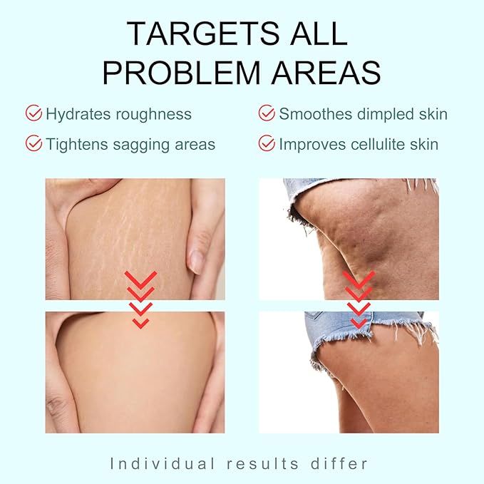 B-TIGHT Body Cream, 200ml Leave-On Booty Enhancing Mask, Firming & Moisturizing Cream, Leave-On Cellulite Mask - Improves Skin Tightness in Buttock Area, Lift sagging skin - 6.76 oz-Velvo Beauty