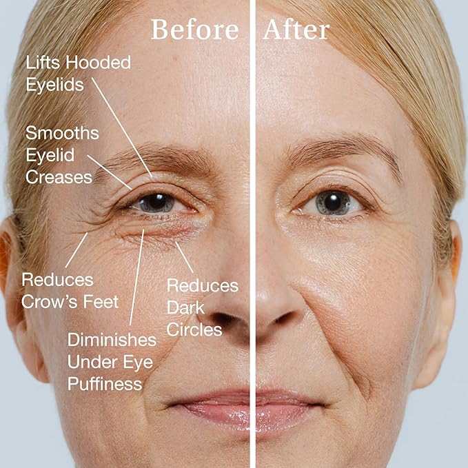 SBLA Eye Lift Wand – Anti-Aging Serum for Eyelids, & Eye Area - With SBLA66Peptide™, Caffeine, Hyaluronic Acid, Niacinamide & Vitamin C - Smooths, Lifts Hooded Lids, Brightens Eyes, Reduces Puffiness-Velvo Beauty
