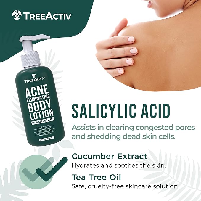 TreeActiv Acne Eliminating Body Lotion 8 fl oz | Clears Body, Back, Butt and Shoulder Acne | Anti-Acne Moisturizer | Prevents Future Breakouts | Cucumber Mint Scent-Velvo Beauty