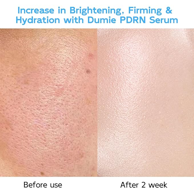 Salmon DNA PDRN Anti-Aging Serum, 5000ppm Salmon Egg DNA Ampoule, 2000ppm Collagen, Glutathione, Niacinamide & 6 Hyaluronic Acids, Korean Skincare for Wrinkles & Radiance,0.05 fl.oz x 30e-Velvo Beauty