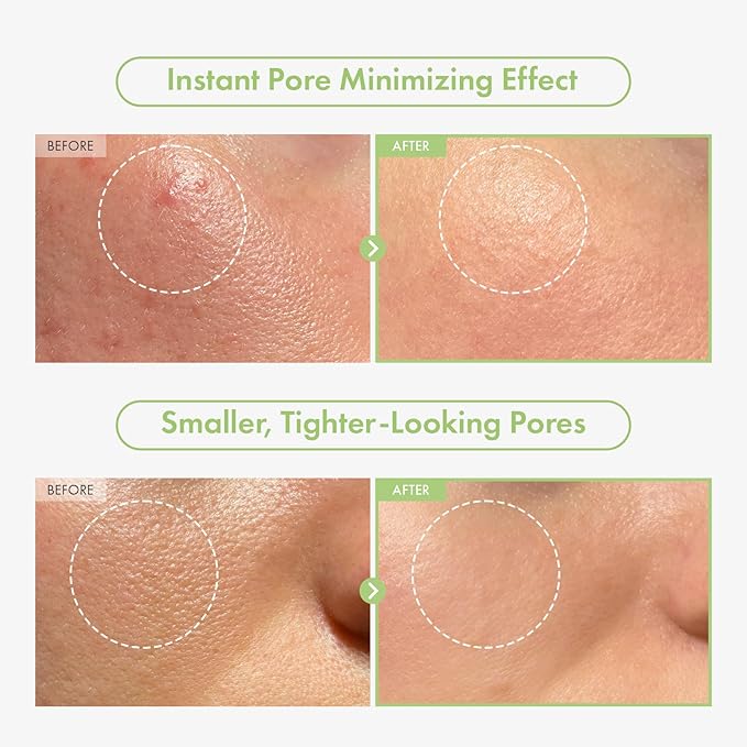 Green Caviar Pore Ampoule With 2,500ppm Green Caviar, Niacinamide, Pore Minimizer, Hydrating, Firming, Pore Tightening, Reduces Pores, Korean Skin Care, 33ml, 1.11 fl.oz.-Velvo Beauty