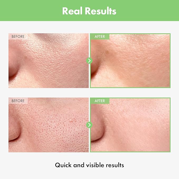 Green Tomato Pore Ampoule with Green Tomato, Witch Hazel and Hyaluronic Acid for Face Moisturizer and Pore Minimizing Treatment, Korean Skincare, 30ml, 1.01 fl. oz.-Velvo Beauty