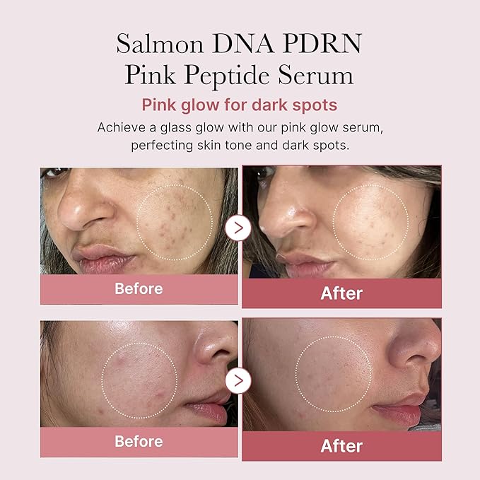 medicube Salmon DNA PDRN Pink Peptide Serum, Pink glow serum, Peptide, Niacinamide, Hydrating & Moisturizing & Firming, Uneven Skin Tone, Korean Skincare | 1.01 fl.oz. (1.01 fl.oz., Salmon DNA PDRN)-Velvo Beauty