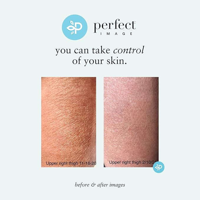 Perfect Image Gly + Sal Exfoliating Body Lotion, 8% Glycolic Acid and 2% Salicylic Acid Lotion Enhanced with Green Tea, Papaya, Bearberry, Licorice and Amino Complex-Velvo Beauty