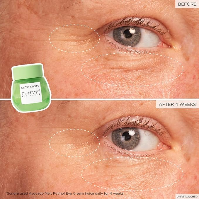 Glow Recipe Avocado Retinol Eye Cream for Wrinkles - Overnight Under Eye Cream for Dark Circles, Firming & Brightening Dull, Puffy Eyes - Time Release Niacinamide & Caffeine Eye Cream (15ml)-Velvo Beauty