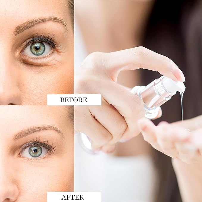 Eye Cream for Dark Circles and Puffiness - Rapid Reduction Under Eye Care Collagen Treatment Serum 1.7 oz-Velvo Beauty