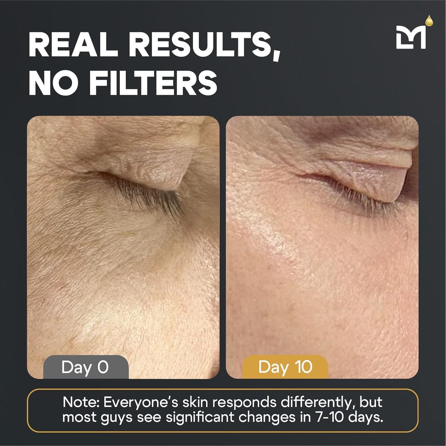 Titan Oscar Anti-Aging Mens Skin Care Kit – Wash, Face Serum, Eye Cream, Mens Face Moisturizer – Men, Skin Care Set – Dark Circles, Wrinkles, Fine Lines – Vitamin C, Peptides, Niacinamide, HA-Velvo Beauty