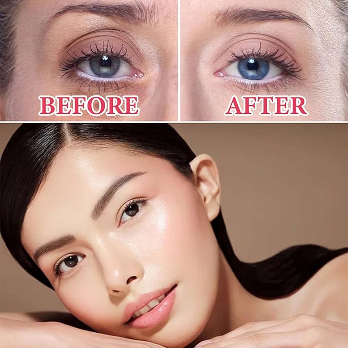 Retinol Eye Cream for Dark Circles and Puffiness,Under Eye Cream with Collagen & Hyaluronic Acid,Fix Wrinkle,Lightweight Lift Eye Cream,Brighten Tighten Eye Cream Gel to Smooth Fine Lines & Hydrate-Velvo Beauty