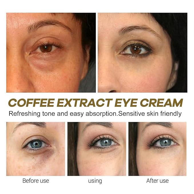 2PCS Caffeine Eye Cream for Dark Circles and Puffiness, Anti-Wrinkle Stay-Up Late Retinol Eye Cream, Tightening & Firming Skin, Dilute Dark Circles-Velvo Beauty