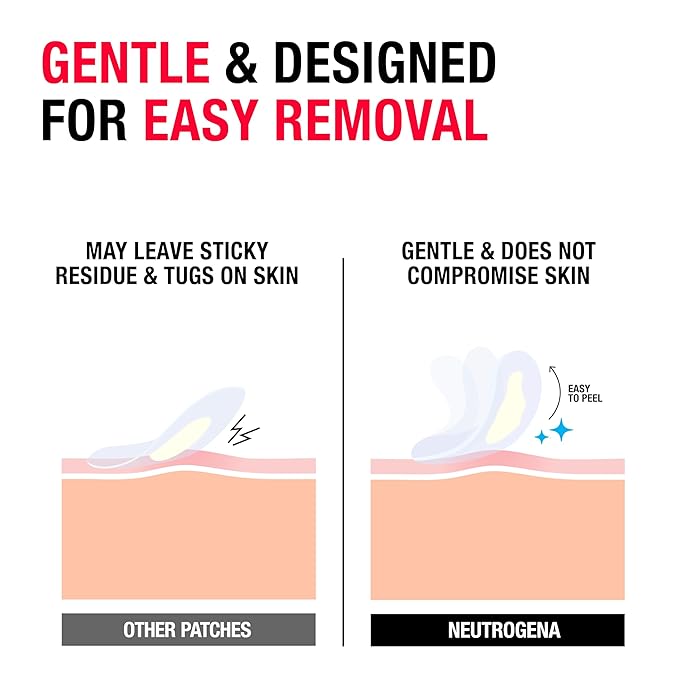 Neutrogena Sensitive Skin Blemish Patches, Acne Patches for Sensitive Skin, Hydrocolloid Treatment Visibly Shrinks Pimples Overnight, 2 Sizes, 30 Count-Velvo Beauty