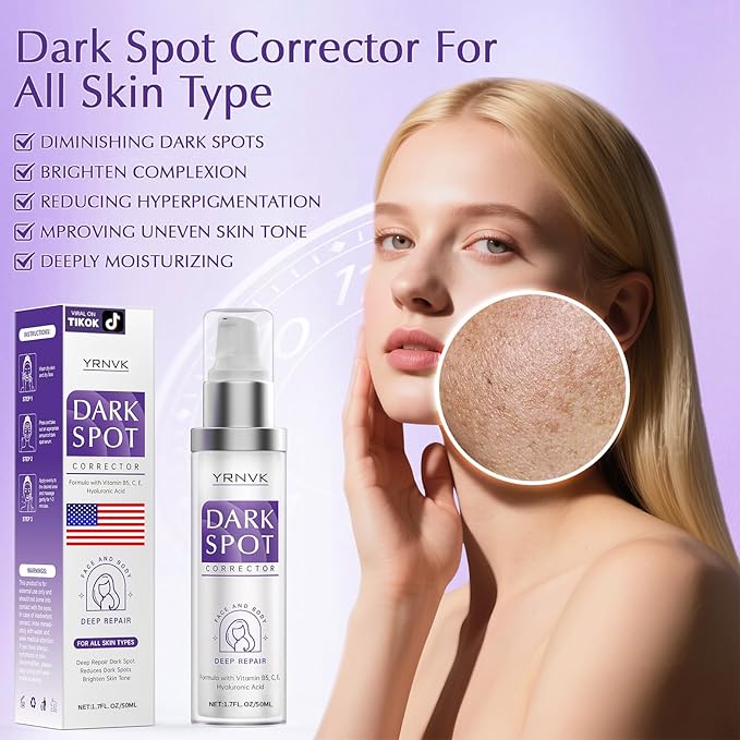 Dark Spot Remover for Face Cream, Dark Spot Corrector, Rapid Tone Repair Retinol Serum for Sun Spots, Age Spots, Skin Brown, Melasma Skin Care with Upgraded Formula Vitamin C for Women 1.7 Fl OZ-Velvo Beauty