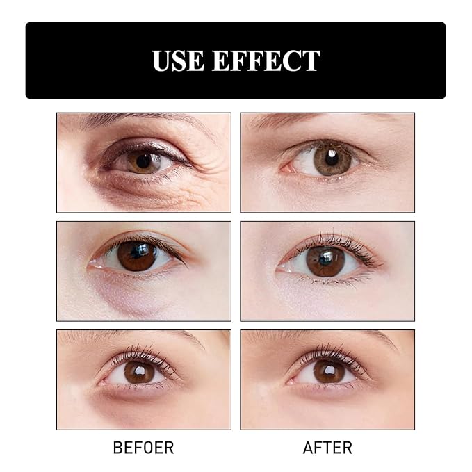 Retinol Snake Venom Peptide Eye Cream, Firming Eye Cream, Anti Ageing Eye Cream, Under Eye Cream For Puffiness and Bags Reduces Fine Lines-Velvo Beauty