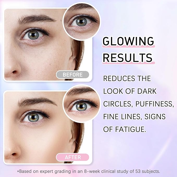5% Caffeine Eye Cream Eye Serum Kit for Dark Circles Under Eye Treatment For Puffiness Bags And Wrinkles Eye Cream Anti Aging Eye Serum & Eye Roller 2 Fl Oz-Velvo Beauty