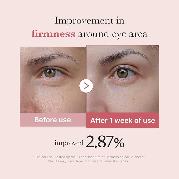 medicube Salmon DNA PDRN Pink Peptide Eye Serum with Niacinamide and 99% Purity Retinol for Fine Lines, Uneven Skin Tone, Korean Skin Care 1.01fl.oz-Velvo Beauty