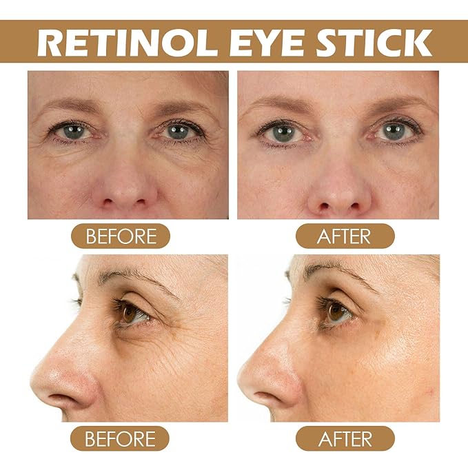 Retinol Eye Stick with Collagen & Hyaluronic Acid Eye Cream for Dark Circle and Puffiness, Brightening Eye Balm Reduces Fine Lines and Bags in 4 Weeks-Velvo Beauty